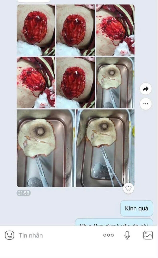 Sensitive Image